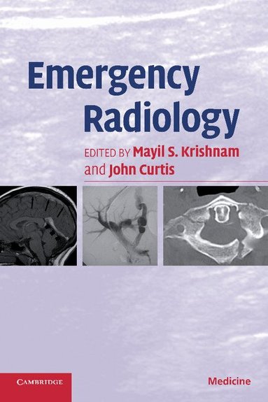Mayil S. Krishnam, John Curtis - Emergency Radiology, Häftad