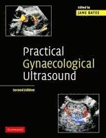 bokomslag Practical Gynaecological Ultrasound