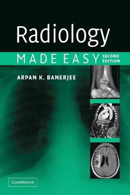 Radiology Made Easy 1