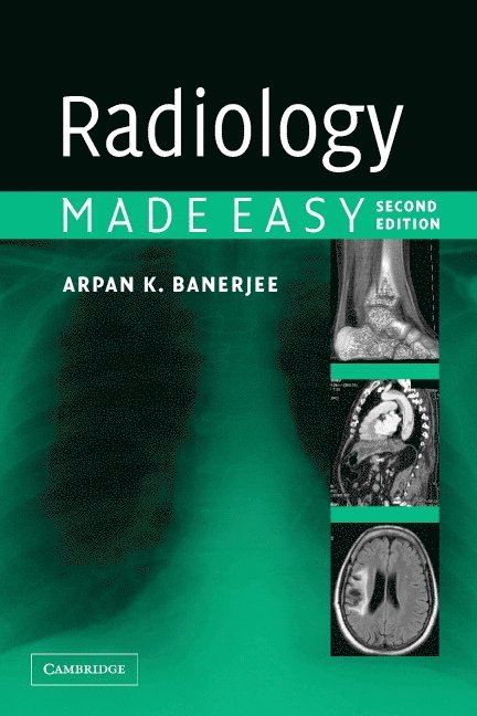 Arpan K. Banerjee, Arpan K Banerjee - Radiology Made Easy, Häftad