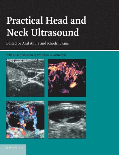 bokomslag Practical Head & Neck Ultrasound