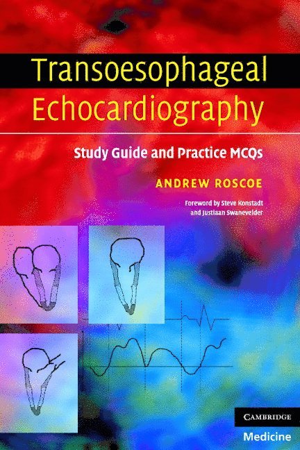 Transoesophageal Echocardiography