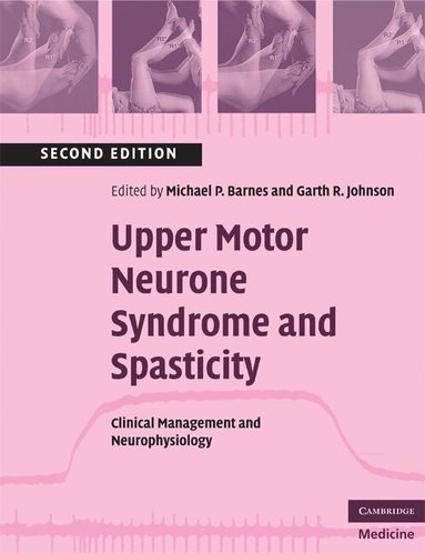 Michael P. Barnes, Garth R. Johnson - Upper Motor Neurone Syndrome and Spasticity, Häftad