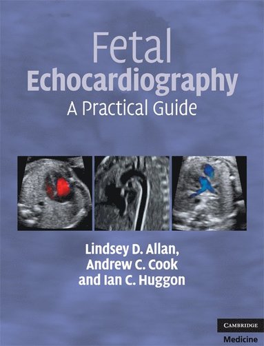 bokomslag Fetal Echocardiography