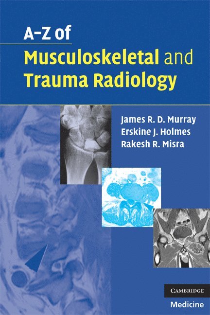 A-Z of Musculoskeletal and Trauma Radiology 1