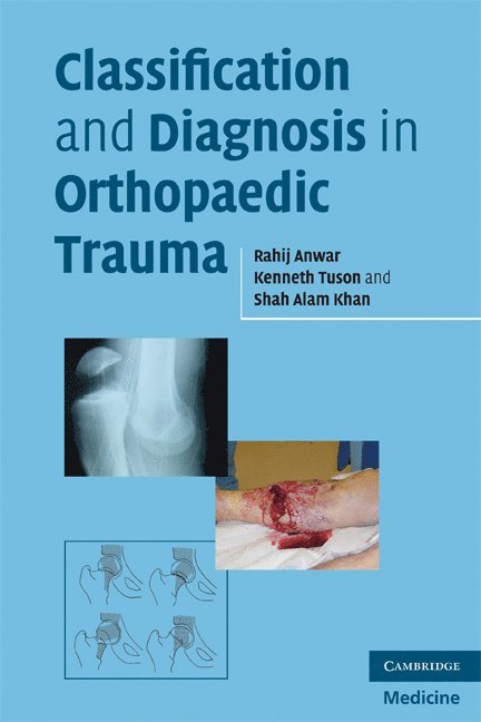 Rahij Anwar, Kenneth W. R. Tuson, Shah Alam Khan, Rahij (Specialist Registrar) Anwar, Kenneth W R Tuson - Classification and Diagnosis in Orthopaedic Trauma, Häftad