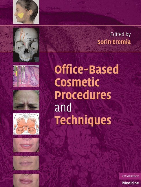 Office-Based Cosmetic Procedures and Techniques 1