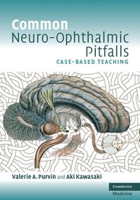 bokomslag Common Neuro-Ophthalmic Pitfalls