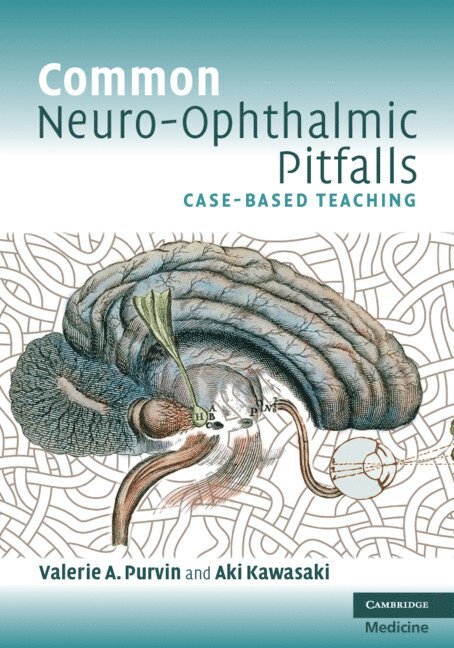 Common Neuro-Ophthalmic Pitfalls 1