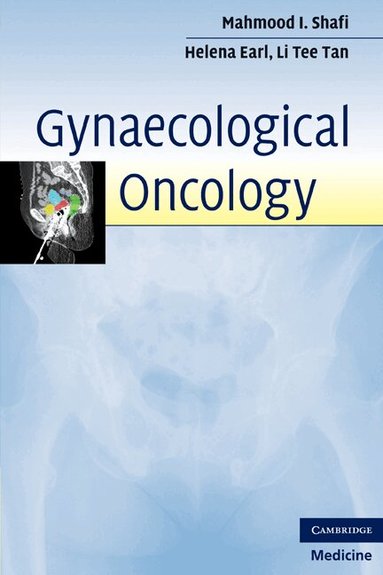 Mahmood I. Shafi, Helena M. Earl, Li Tee Tan - Gynaecological Oncology, Häftad
