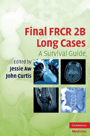 Jessie Aw, John Curtis - Final FRCR 2B Long Cases, Häftad