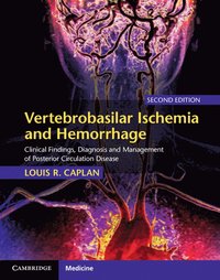 bokomslag Vertebrobasilar Ischemia and Hemorrhage