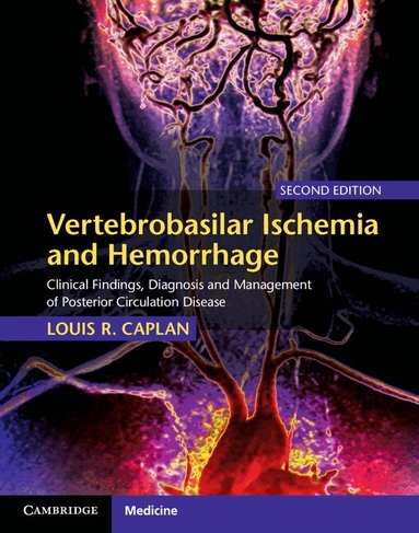 Louis R. Caplan - Vertebrobasilar Ischemia and Hemorrhage, Inbunden