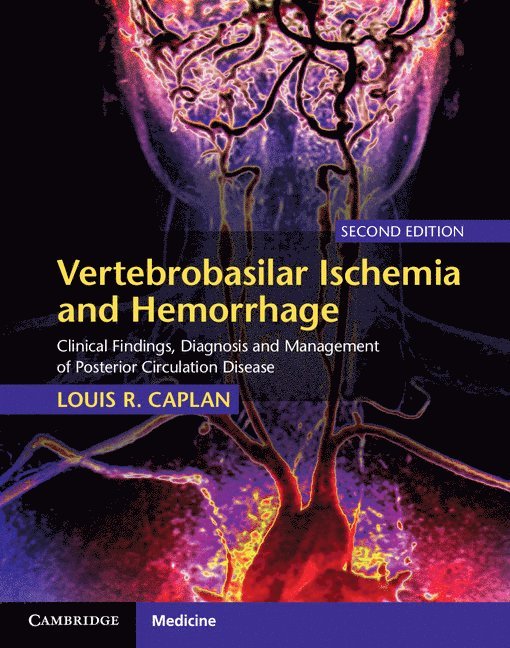 Vertebrobasilar Ischemia and Hemorrhage 1