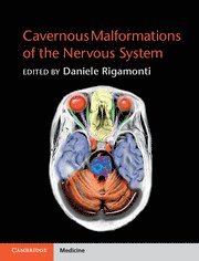 Daniele Rigamonti, Daniele (The Johns Hopkins University) Rigamonti - Cavernous Malformations of the Nervous System, Inbunden