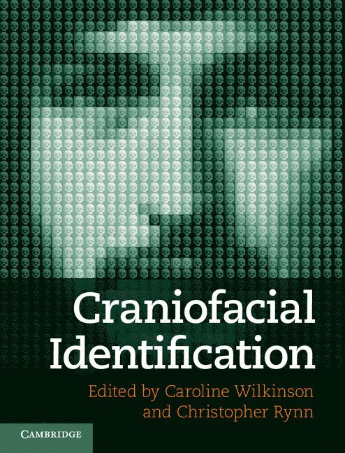 Craniofacial Identification 1