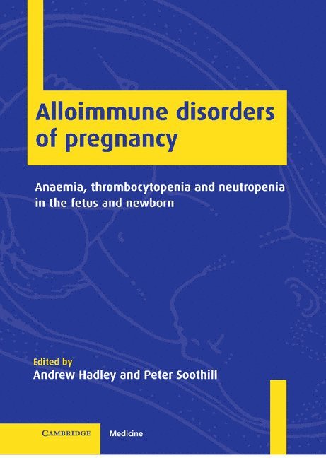 Alloimmune Disorders of Pregnancy 1