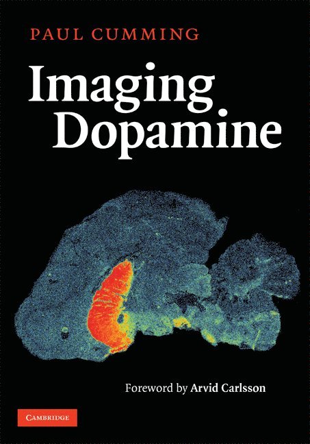 Imaging Dopamine 1