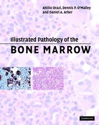 bokomslag Illustrated Pathology of the Bone Marrow