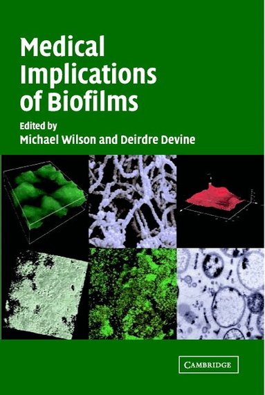 Michael Wilson, Deirdre Devine - Medical Implications of Biofilms, Inbunden