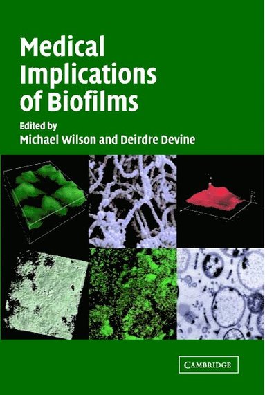 bokomslag Medical Implications of Biofilms