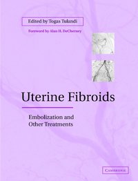 bokomslag Uterine Fibroids