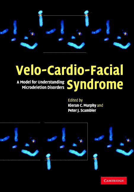 Velo-Cardio-Facial Syndrome 1