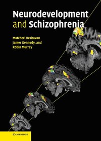 bokomslag Neurodevelopment and Schizophrenia