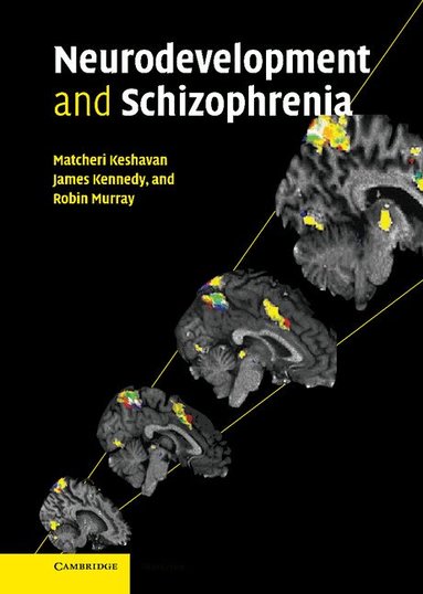 Robin Murray, Matcheri S. Keshavan, James L. Kennedy, Robin M. Murray - Neurodevelopment and Schizophrenia, Inbunden