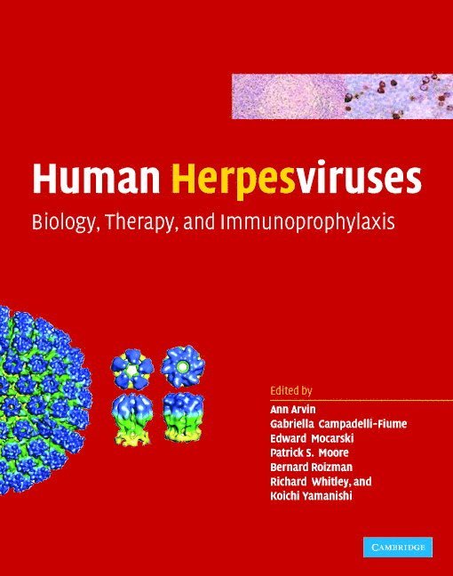 Ann Arvin, Gabriella Campadelli-Fiume, Edward Mocarski, Patrick S Moore, Bernard Roizman, Richard Whitley, Koichi Yamanishi - Human Herpesviruses, Inbunden