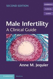 bokomslag Male Infertility