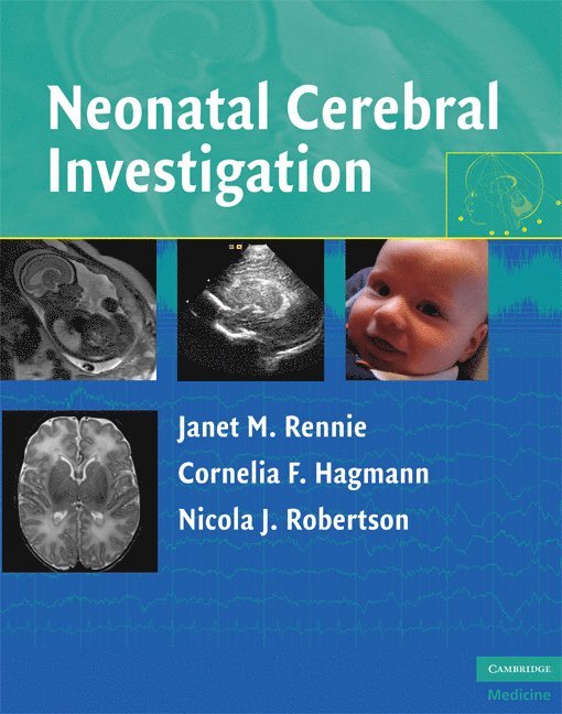Neonatal Cerebral Investigation 1