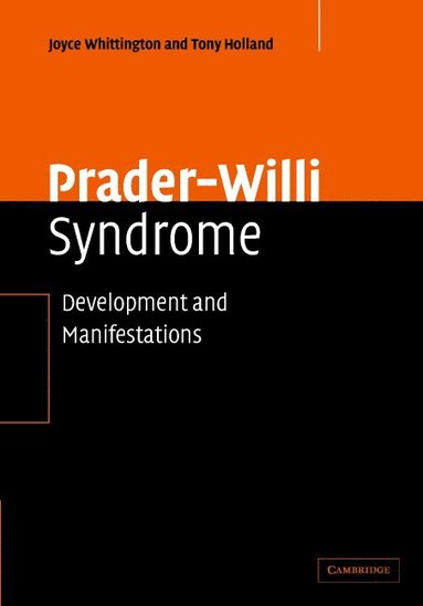 bokomslag Prader-Willi Syndrome