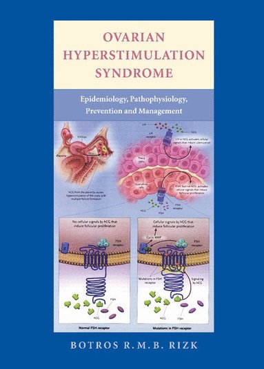 bokomslag Ovarian Hyperstimulation Syndrome