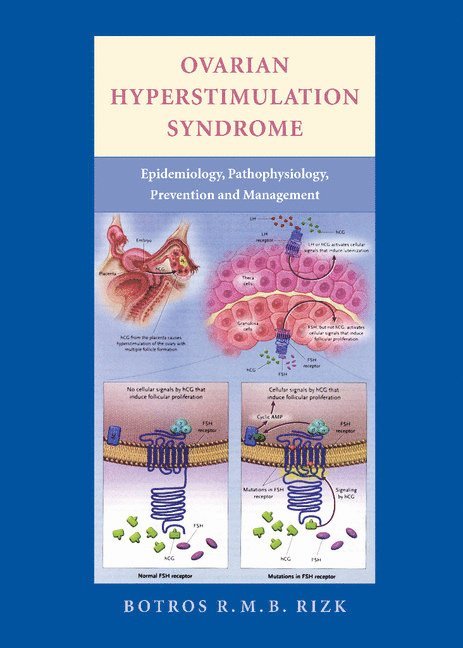 Botros Rizk, University of South Alabama) Rizk, Botros (Professor and Head of Reproductive Endocrinology, Botros R. M. B. Rizk - Ovarian Hyperstimulation Syndrome, Inbunden