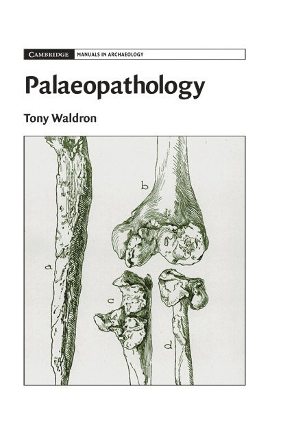 Palaeopathology 1