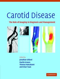 bokomslag Carotid Disease