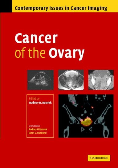 Rodney Reznek - Cancer of the Ovary, Inbunden