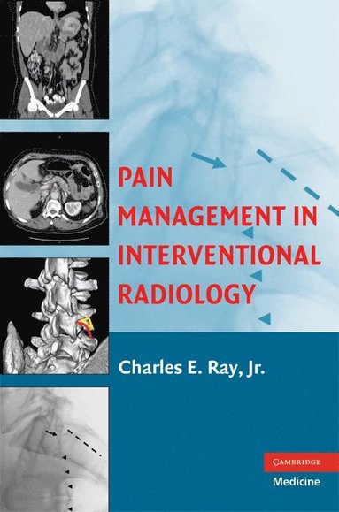 bokomslag Pain Management in Interventional Radiology