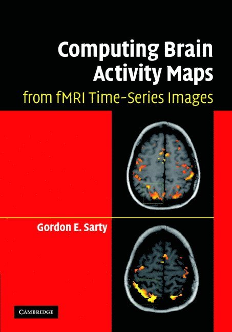 Canada) Sarty, Gordon E. (University of Saskatchewan, Gordon E. Sarty, Gordon E Sarty - Computing Brain Activity Maps from fMRI Time-Series Images, Inbunden