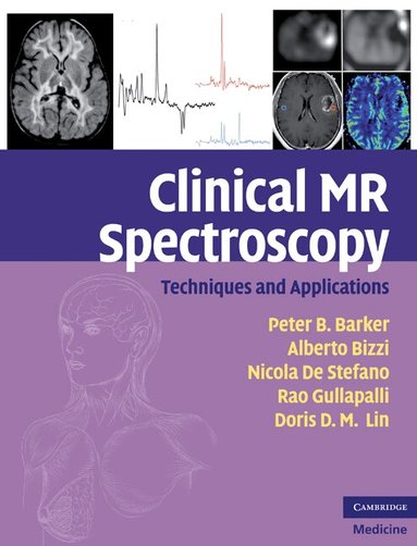 Peter B. Barker, Alberto Bizzi, Nicola De Stefano, Rao Gullapalli, Doris D. M. Lin - Clinical MR Spectroscopy, Inbunden