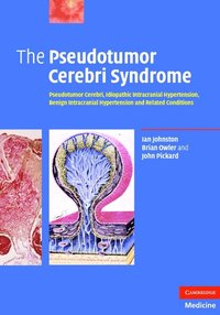 bokomslag The Pseudotumor Cerebri Syndrome