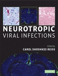 bokomslag Neurotropic Viral Infections