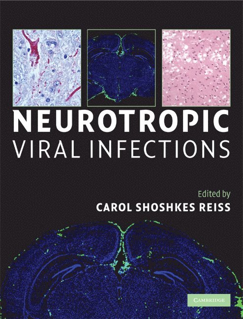 Neurotropic Viral Infections 1