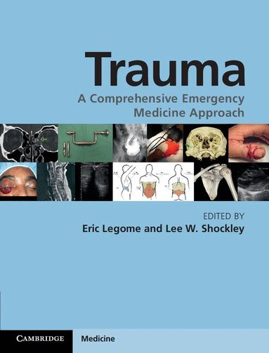 Eric Legome, Lee W. Shockley - Trauma, Inbunden