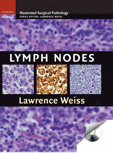 bokomslag Lymph Nodes