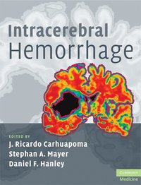bokomslag Intracerebral Hemorrhage
