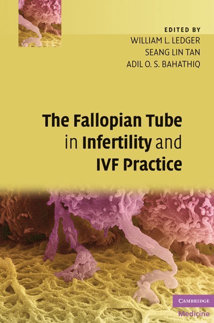 William L. Ledger, Seang Lin Tan, Adil O. S. Bahathiq, William L. (University of Sheffield) Ledger, Montreal) Tan, Seang Lin (McGill University - Fallopian Tube in Infertility and IVF Practice, Inbunden
