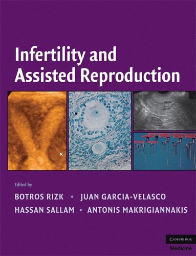 bokomslag Infertility and Assisted Reproduction