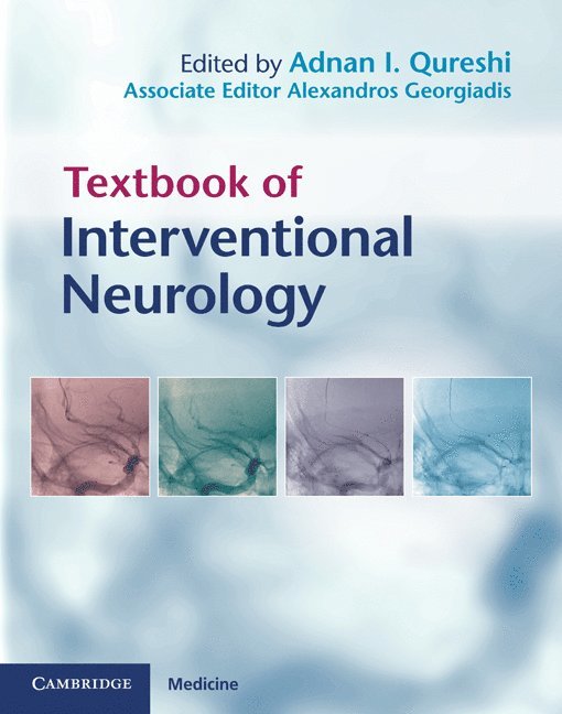 Textbook of Interventional Neurology 1